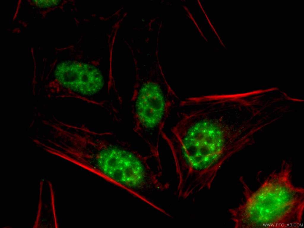 P15RS Polyclonal antibody