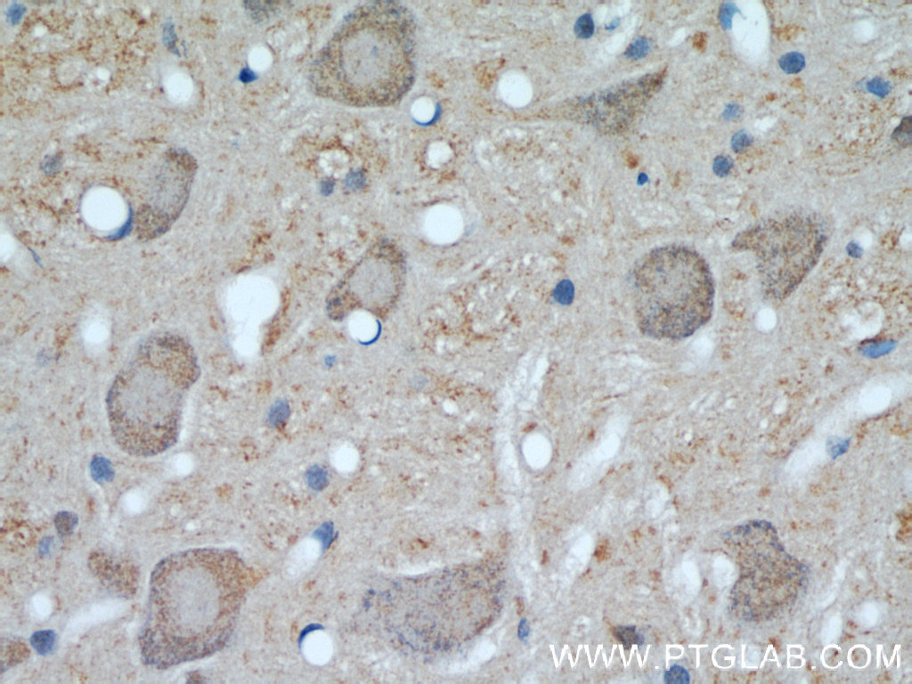 UCP1 Polyclonal antibody