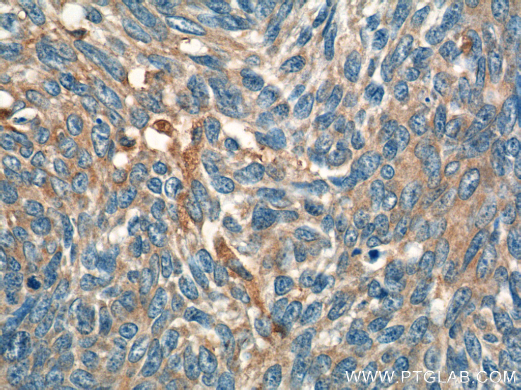 IL-19 Polyclonal antibody
