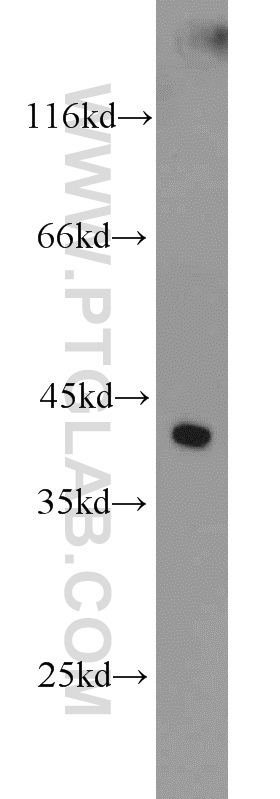 FOXQ1 Polyclonal antibody