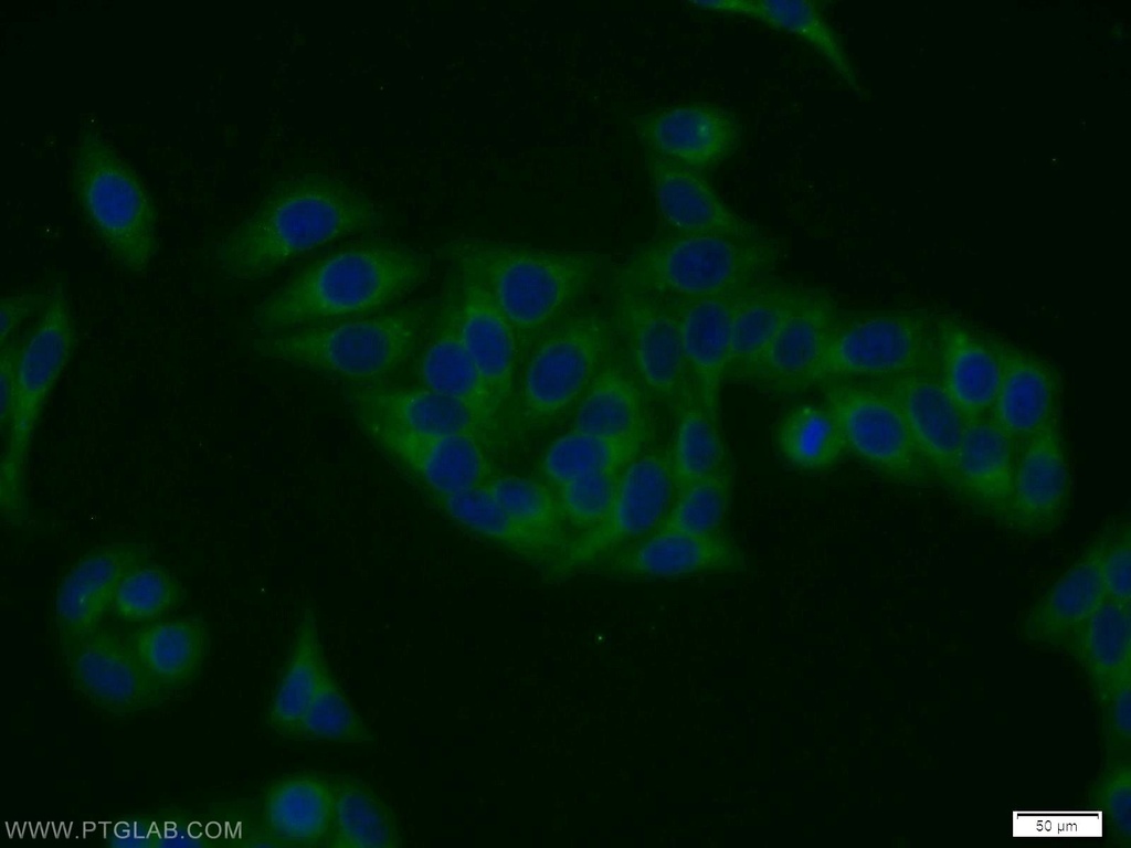 TPCN1 Polyclonal antibody