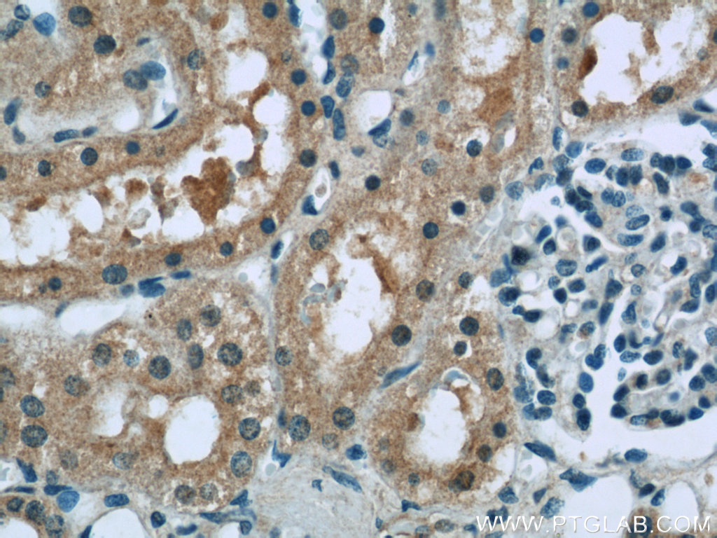 RSK2 Polyclonal antibody