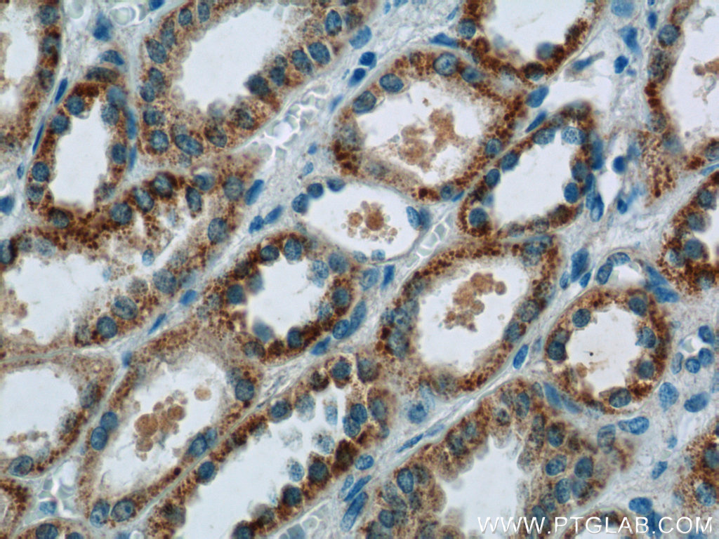 CCDC27 Polyclonal antibody