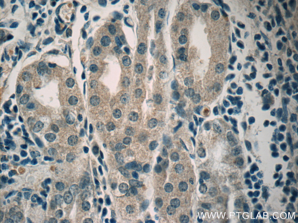 ADM2 Polyclonal antibody