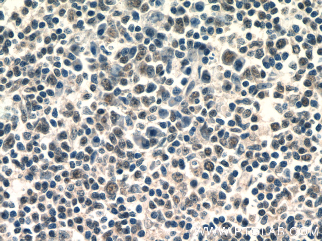 AKNA Polyclonal antibody