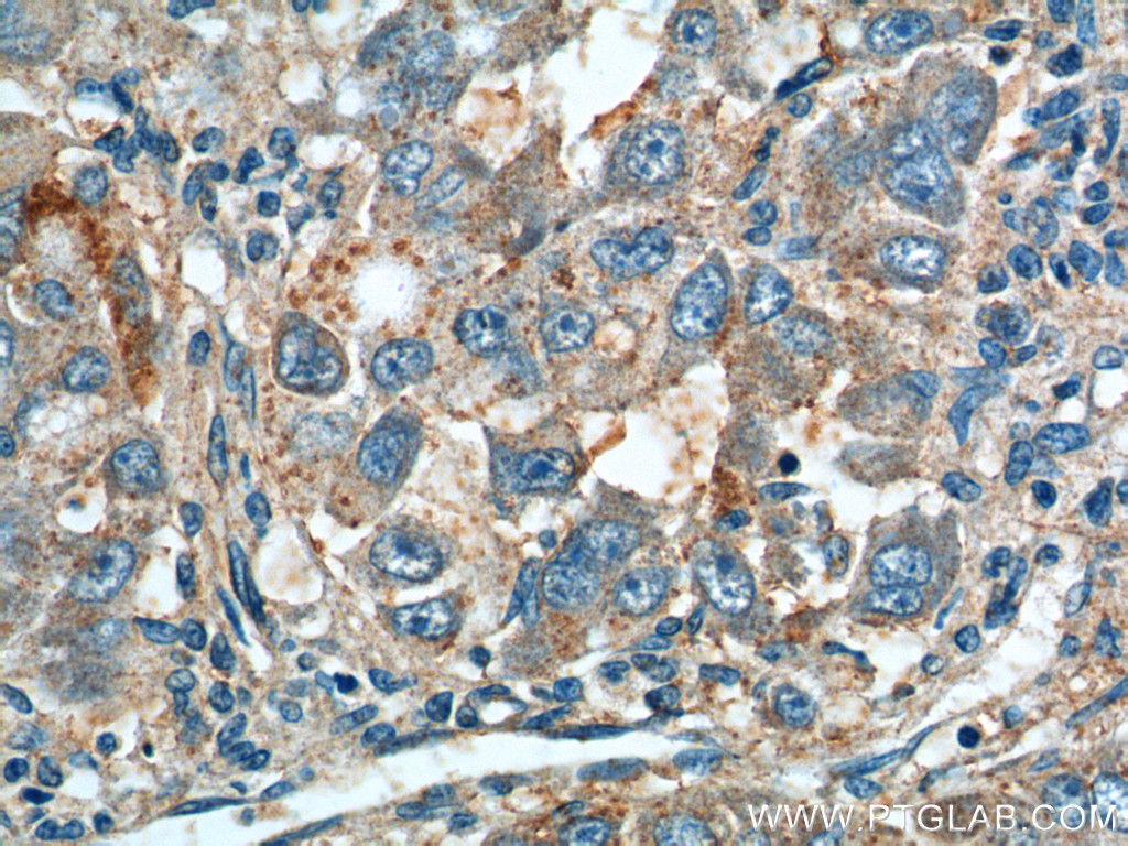 ANGPTL8/Betatrophin Polyclonal antibody