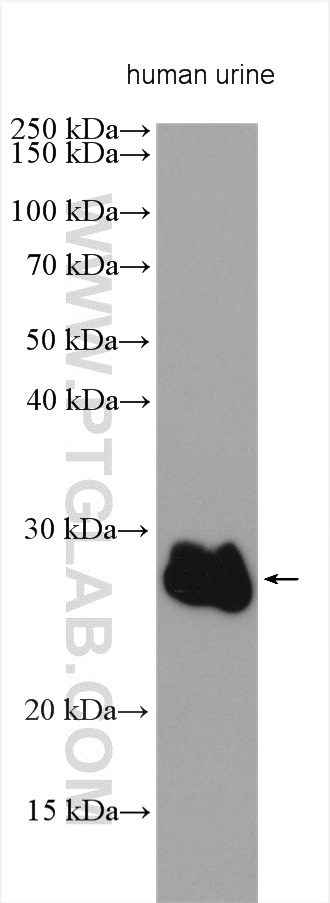 ZG16B Polyclonal antibody