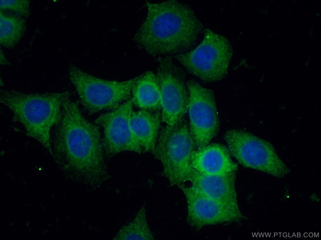 CLIP1 Polyclonal antibody
