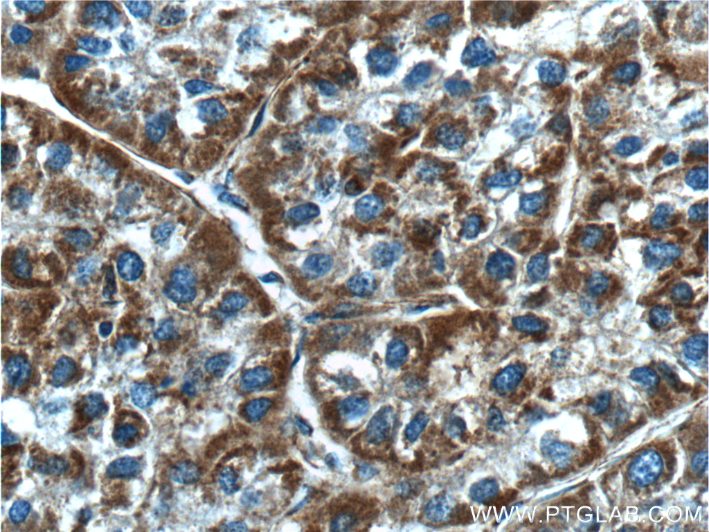 NDUFB5 Polyclonal antibody