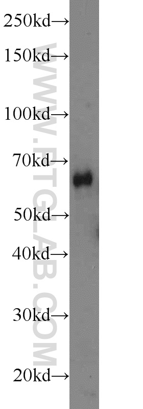 ODF2L Polyclonal antibody