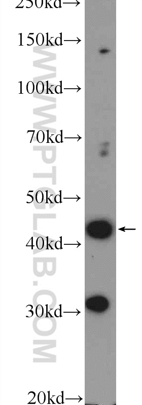 BTBD8 Polyclonal antibody