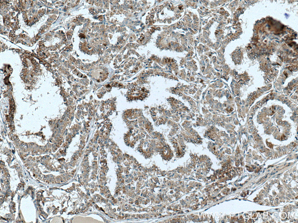 TNFSF18 Polyclonal antibody