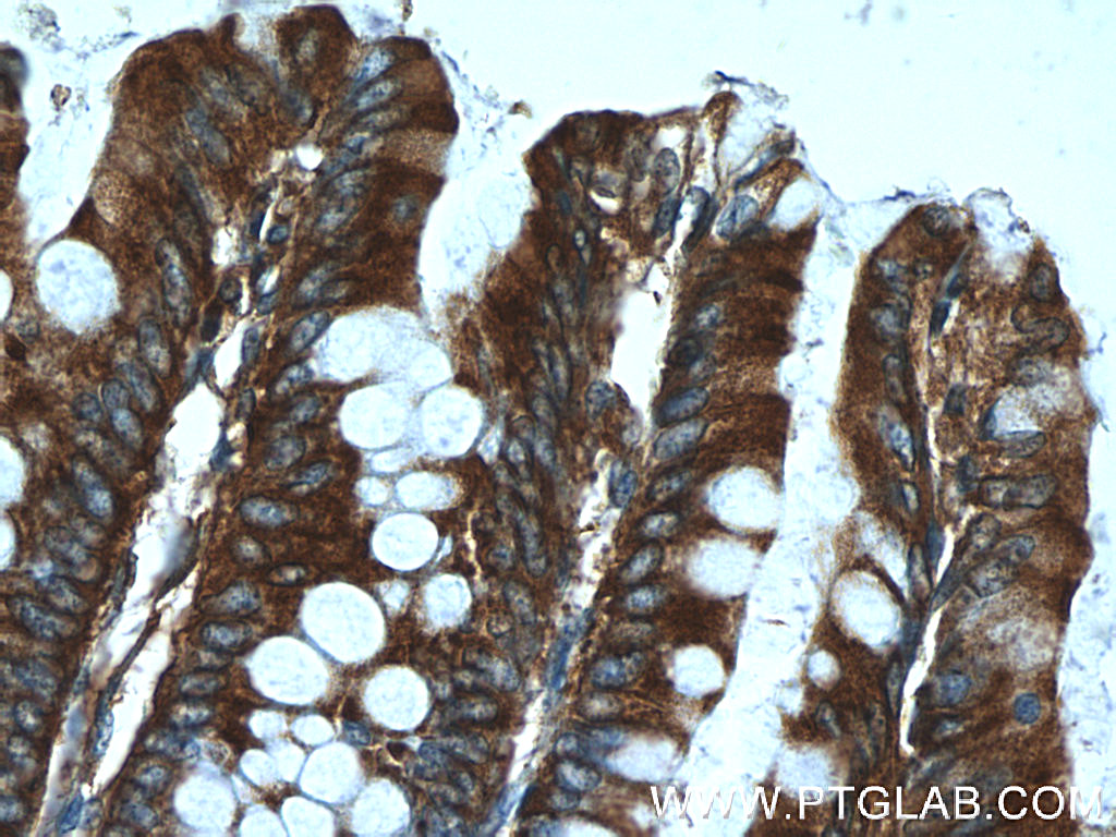AFAP1L1 Polyclonal antibody
