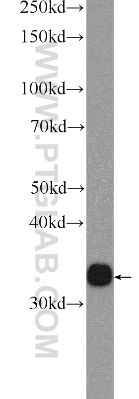 AKR1D1 Polyclonal antibody