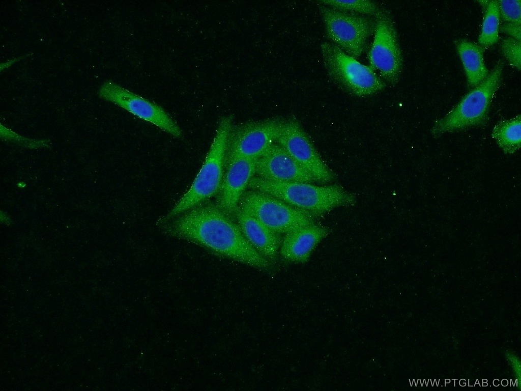 SOLO Polyclonal antibody