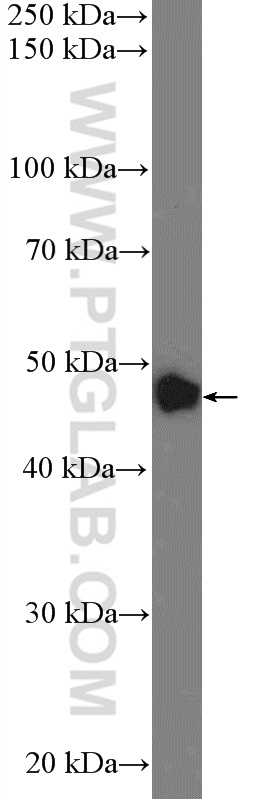 ZNF572 Polyclonal antibody