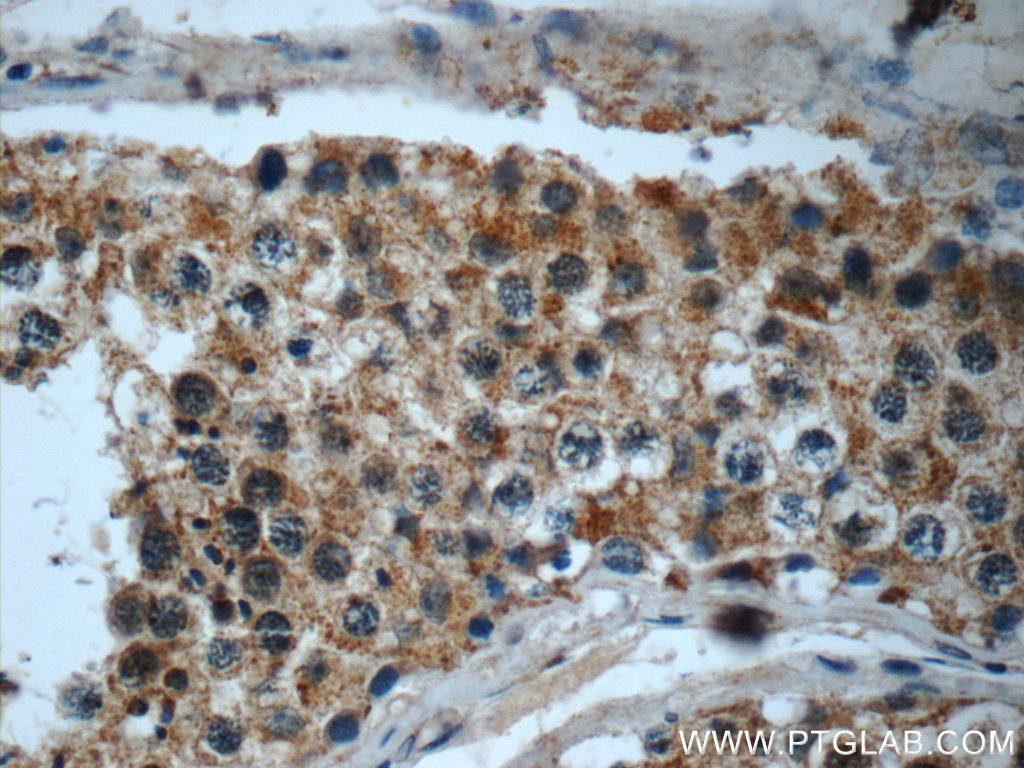 LY6H Polyclonal antibody