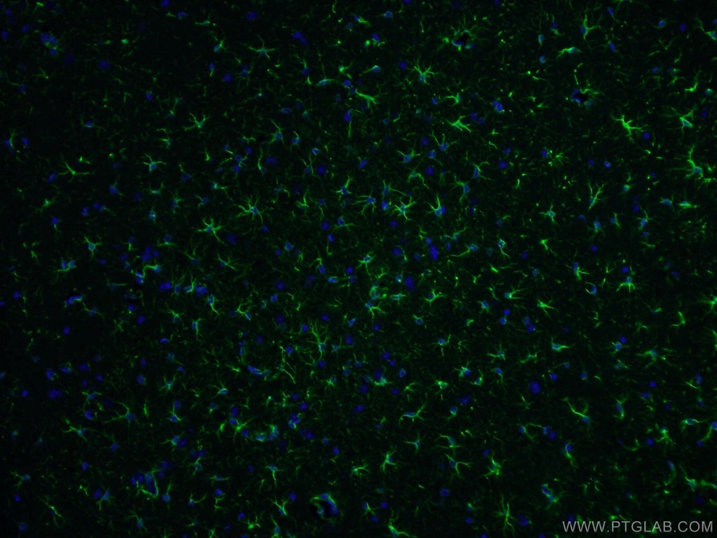GFAP Polyclonal antibody