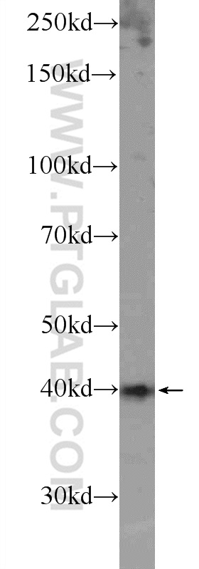 SOX12 Polyclonal antibody
