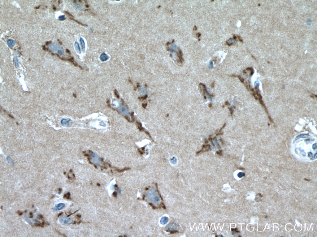 FRMPD4 Polyclonal antibody