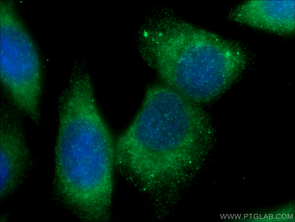 CHPF N-terminal Polyclonal antibody