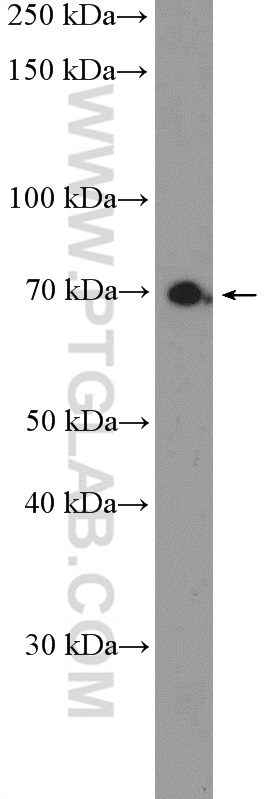 MPEG1 Polyclonal antibody