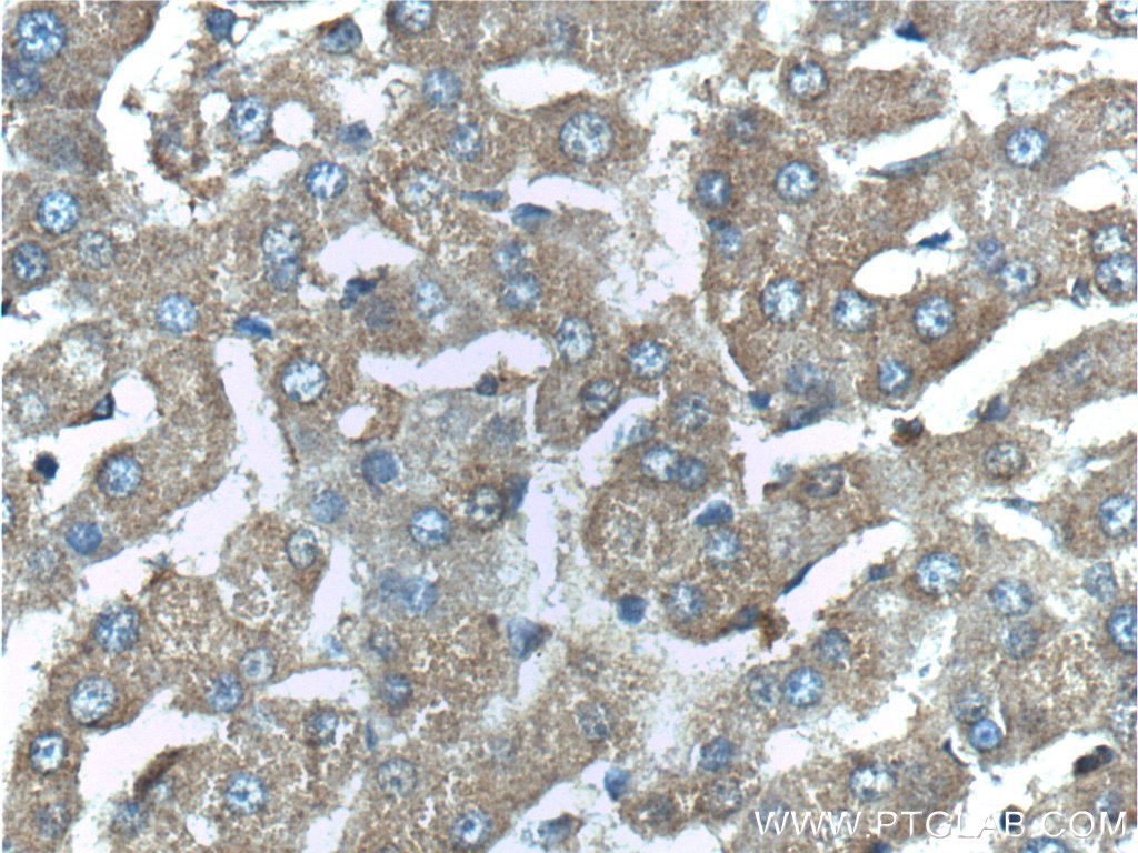 G6PC3 Polyclonal antibody
