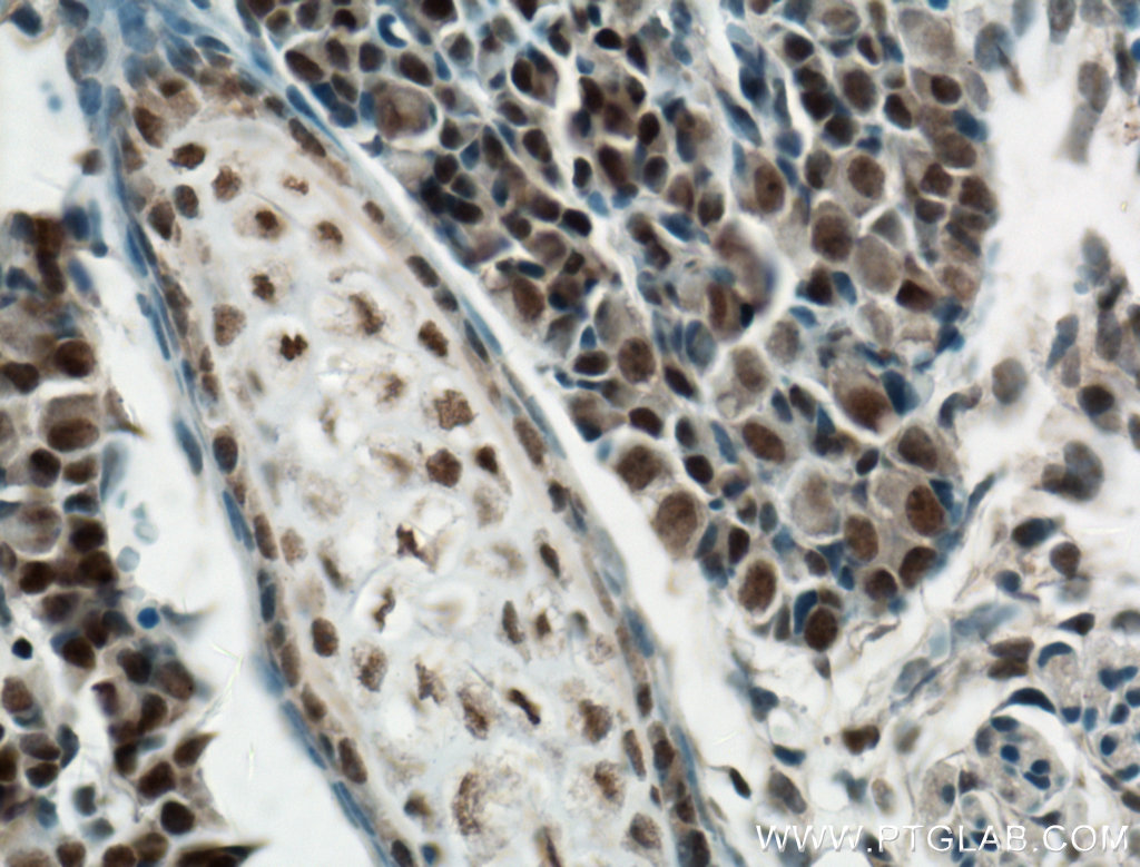 RCOR2 Polyclonal antibody
