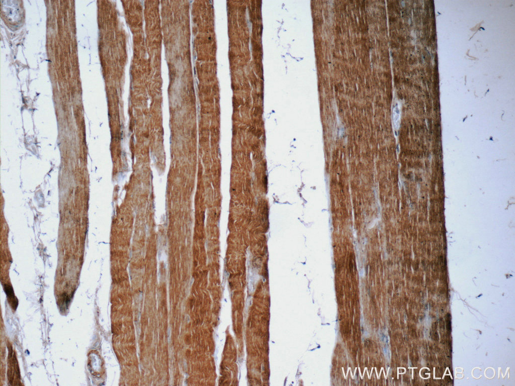 EB3 Polyclonal antibody