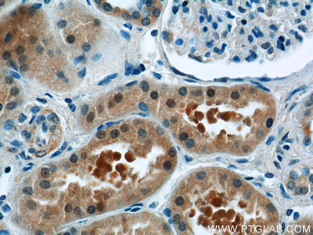 ZBTB20 Polyclonal antibody