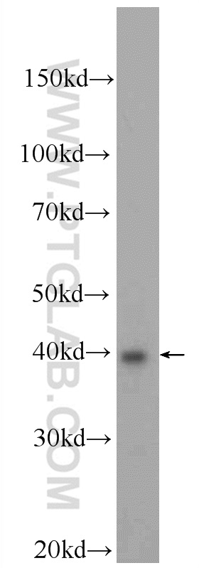 BRMS1L Polyclonal antibody