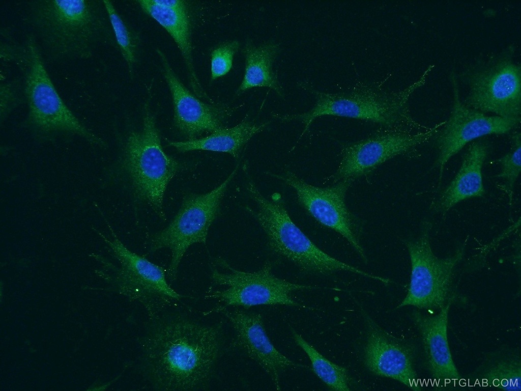 ATPBD4 Polyclonal antibody