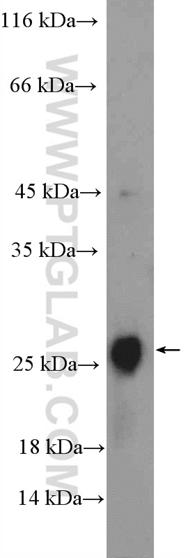 CLRN2 Polyclonal antibody