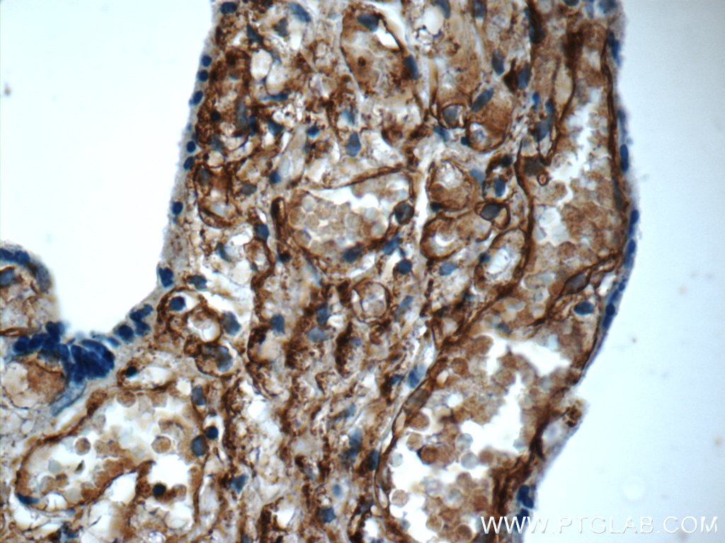 AMPD3 Polyclonal antibody