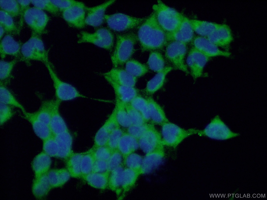 MUTED/BLOC1S5 Polyclonal antibody
