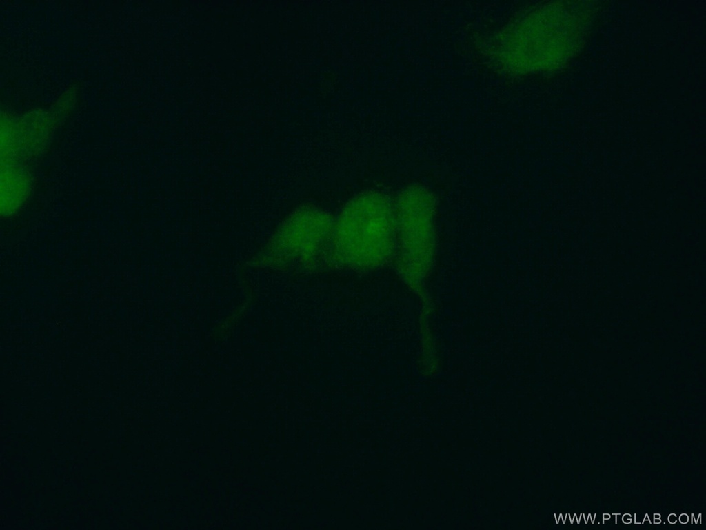 LIN28B Polyclonal antibody