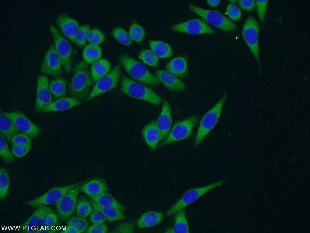 CCDC105 Polyclonal antibody