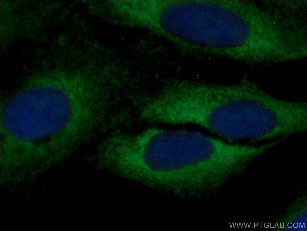 ARMC7 Polyclonal antibody