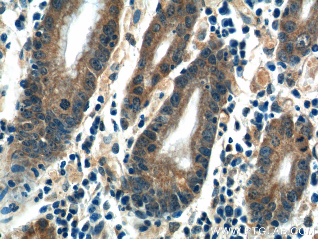 CMC1 Polyclonal antibody