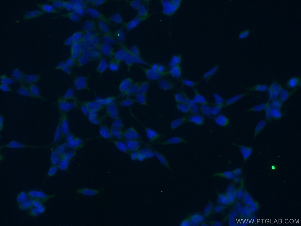 ANKRD50 Polyclonal antibody