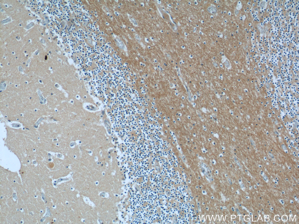 ANKRD57 Polyclonal antibody