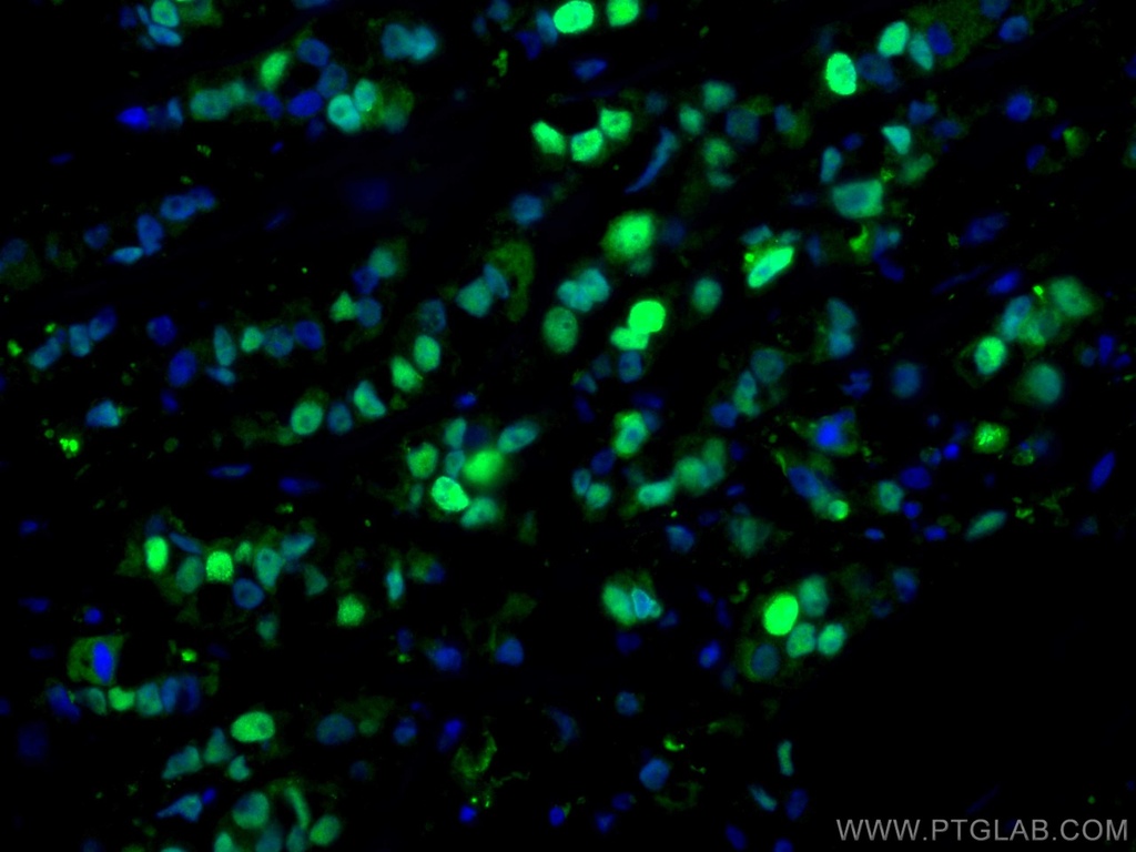 PCNA Polyclonal antibody