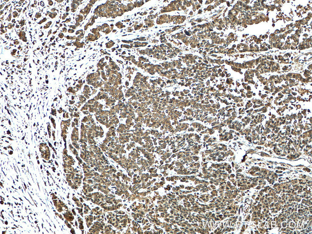 KRT23 Polyclonal antibody