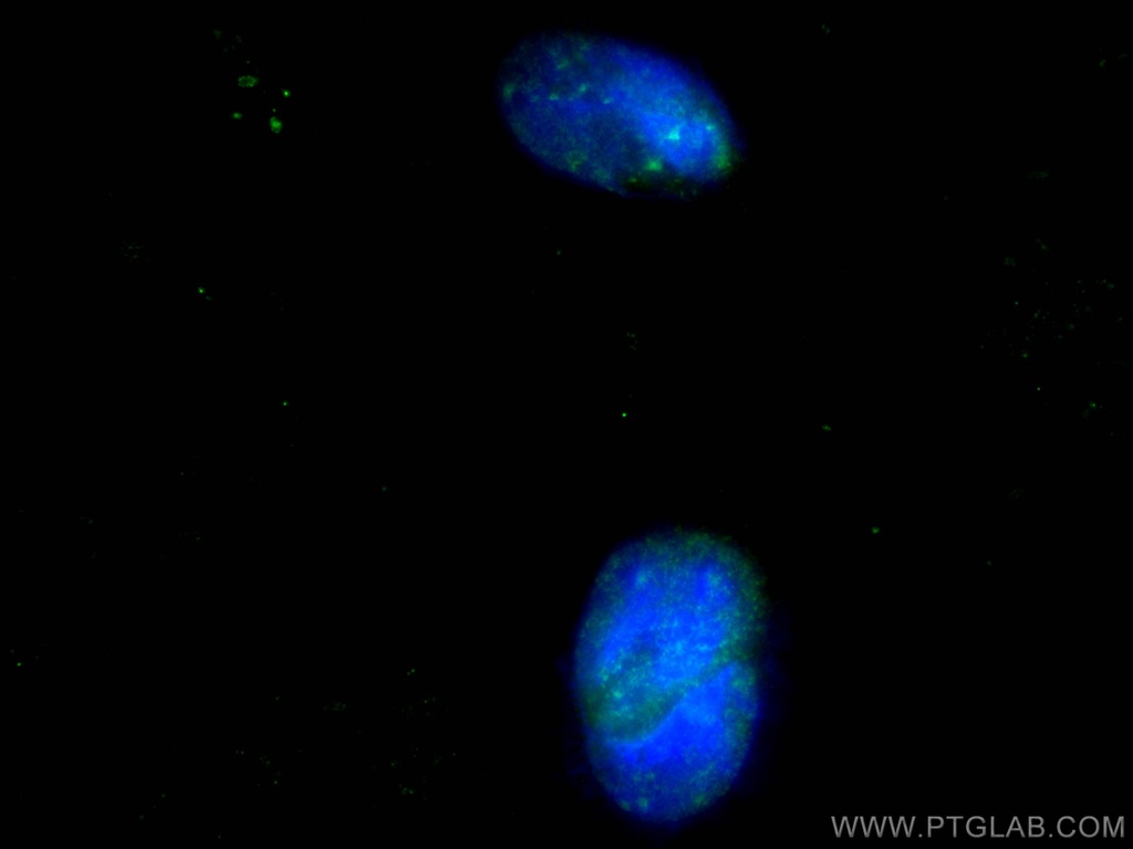 Glucocorticoid receptor Polyclonal antibody