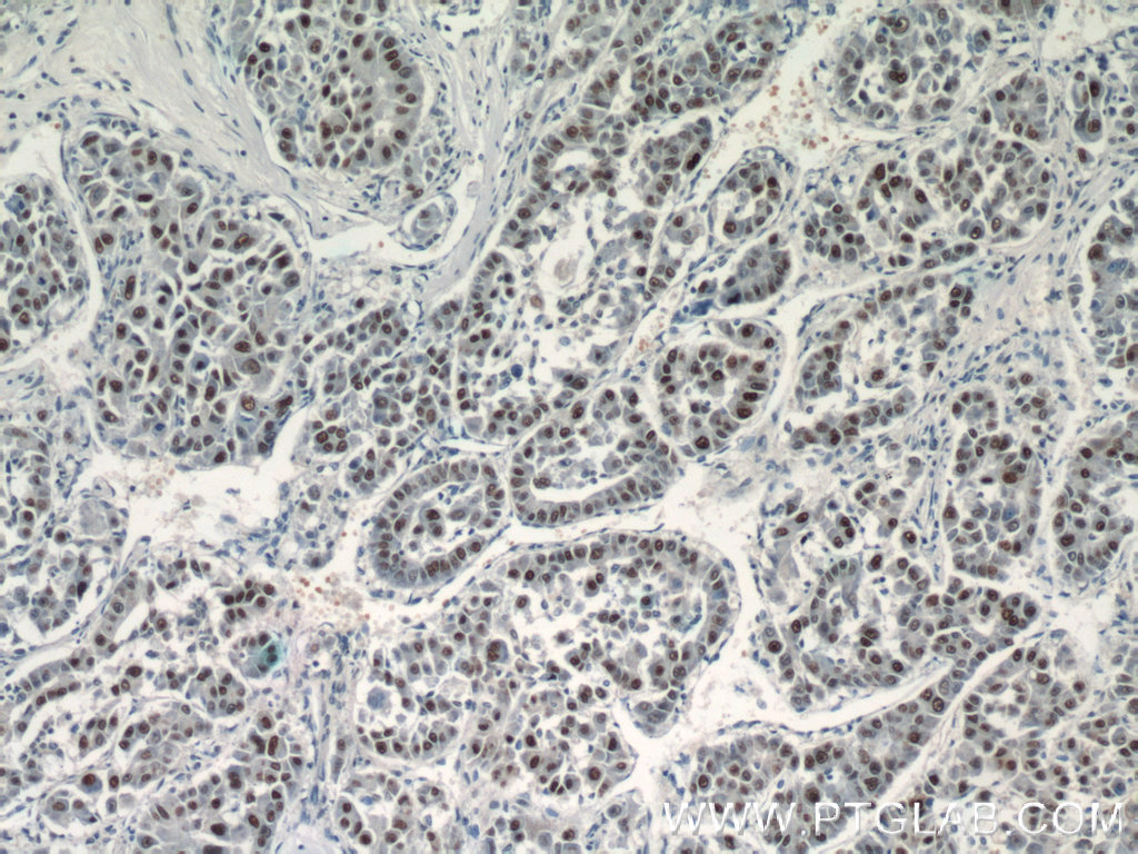 SGF29 Polyclonal antibody