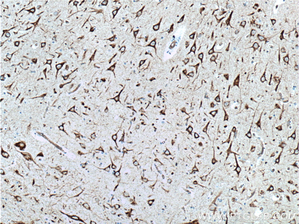 NHEDC2 Polyclonal antibody