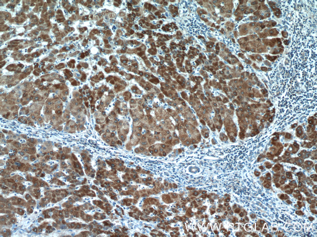 ITIH4 Polyclonal antibody