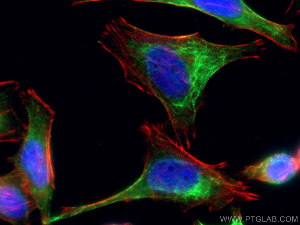 Rac1 Polyclonal antibody