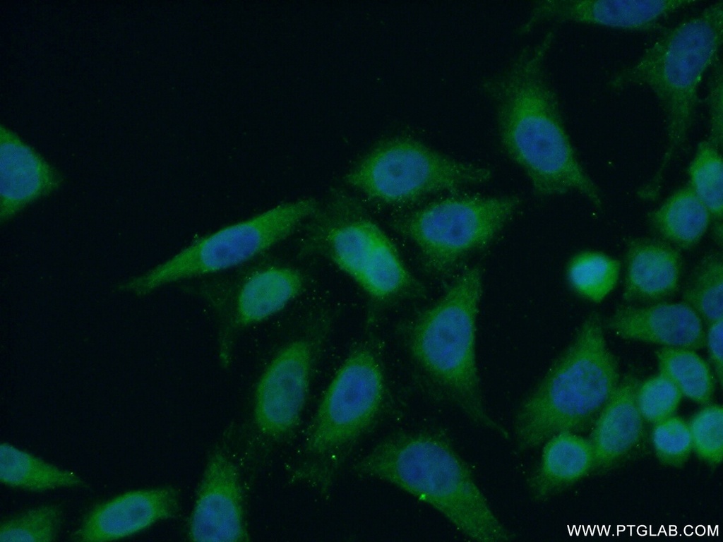 ANKLE1 Polyclonal antibody