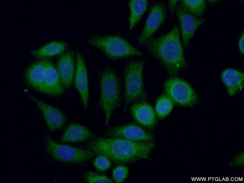 SPRED2 Polyclonal antibody